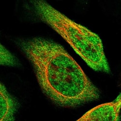 ZBTB2 Antibody, Novus Biologicals 0.1mL; Unlabeled:Antibodies, Polyclonal